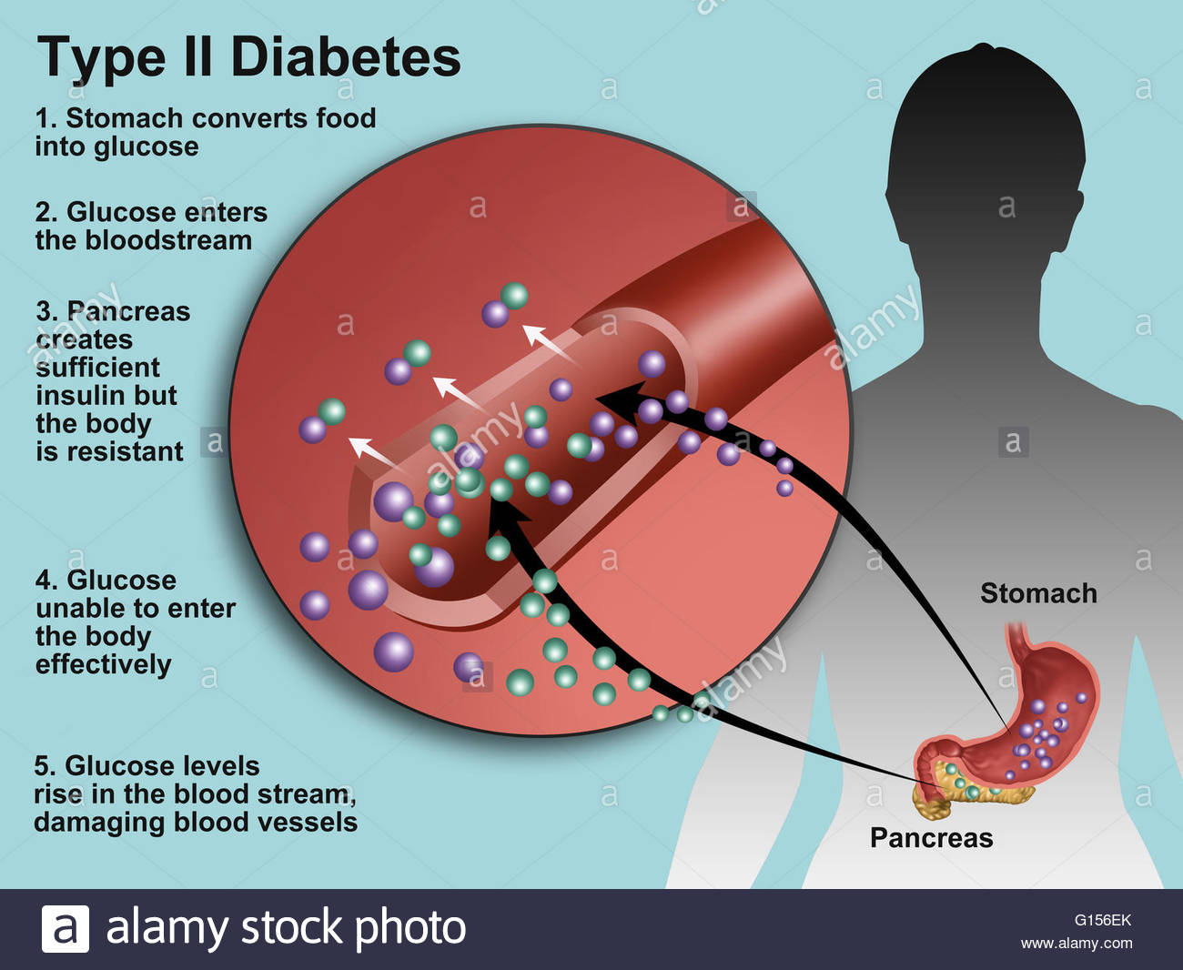 Diabetes In Seniors - Insulin Graphic