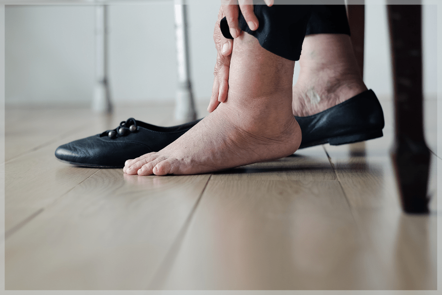 American Heart Month - Elderly woman rubbing her swollen ankles - MeetCaregivers